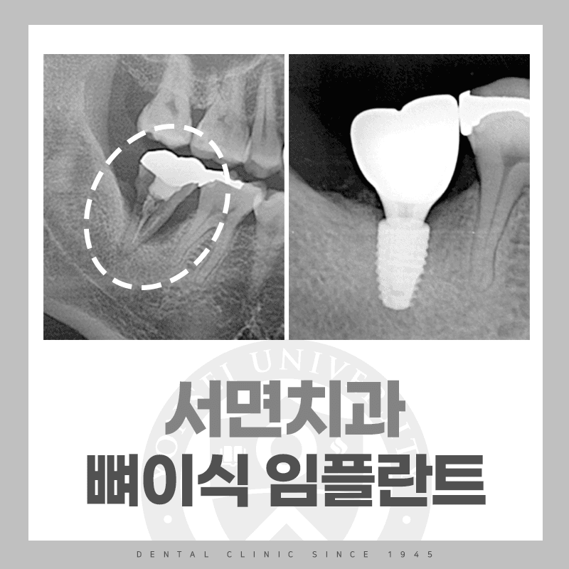 테스트 공지사항